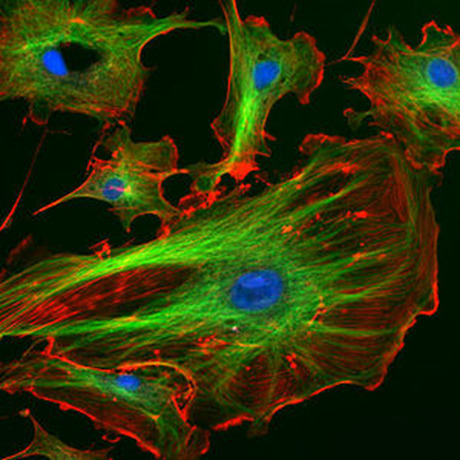 Marquage du cytosquelette (en vert les microtubules, en rouge l'actine, en bleu les lamines)